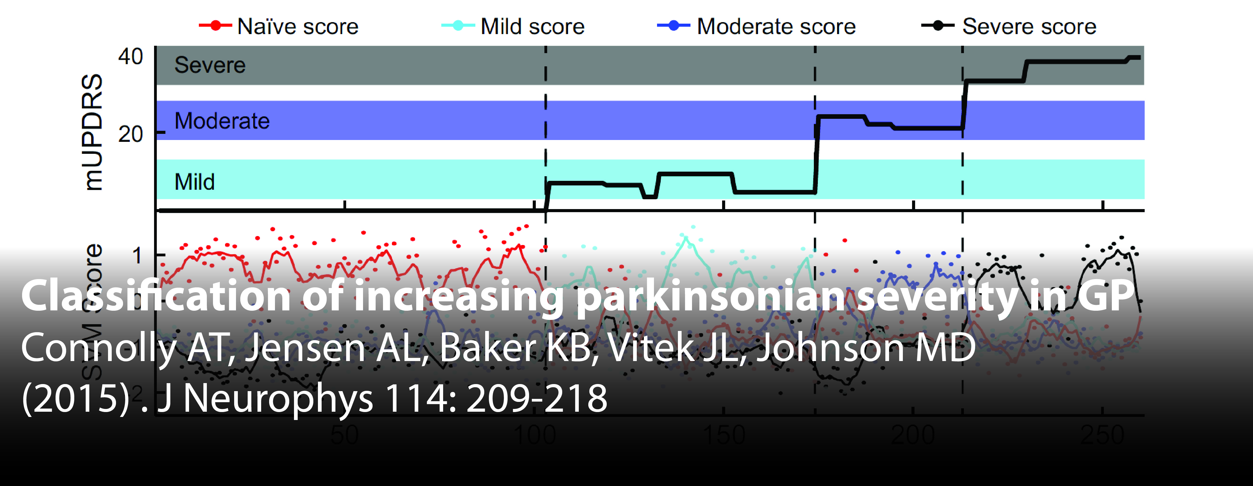 Classification of increasing parkinsonian severity in GP